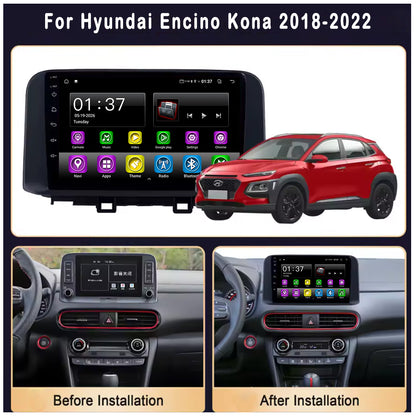 10 inch Android 15 Car Radio  for Hyundai Encino Kona 2018-2022 with Touch Screen, GPS, Bluetooth, WiFi, Apple CarPlay, Android Auto, Rear Camera Support, Smart Multimedia Player